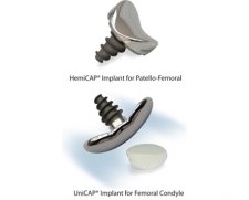 Arthrosurface | Knee HemiCAP systems